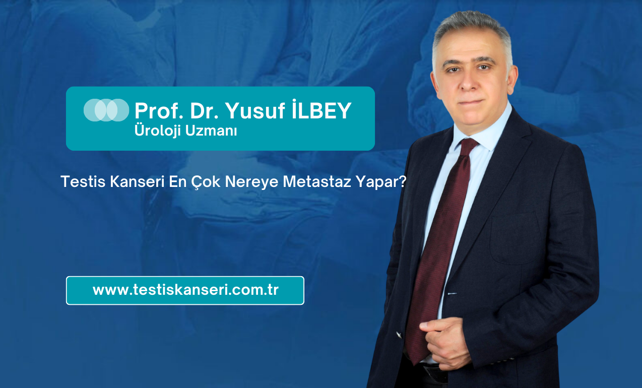 Testis Kanseri En Çok Nereye Metastaz Yapar?